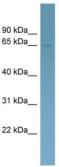 WB Suggested Anti-HOMEZ Antibody Titration: 0.2-1 ug/ml; Positive Control: ACHN cell lysate