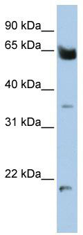 WB Suggested Anti-HOMEZ Antibody Titration: 0.2-1 ug/ml; ELISA Titer: 1: 1562500; Positive Control: 721_B cell lysate
