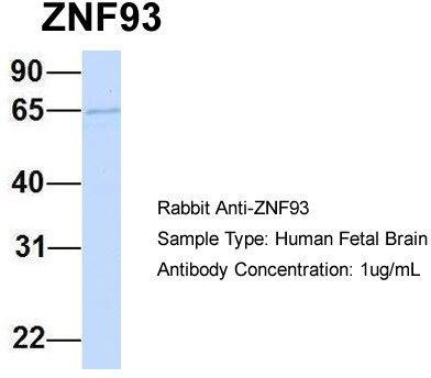 Host: Rabbit; Target Name: ZNF93; Sample Tissue: Human Fetal Brain; Antibody Dilution: 1.0 ug/ml
