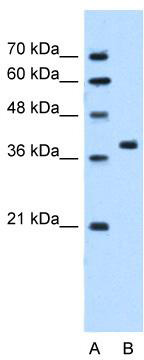 WB Suggested Anti-RUNDC2A Antibody Titration: 5.0 ug/ml; Positive Control: HepG2 cell lysate