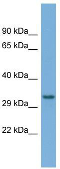Host: Rabbit; Target Name: TAMM41; Sample Tissue: OVCAR-3 Whole Cell lysates; Antibody Dilution: 1.0 ug/ml