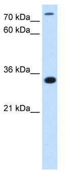 WB Suggested Antibody Titration: 2.5 ug/ml; Positive Control: HepG0