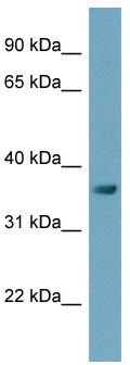 WB Suggested Anti-C3orf31 Antibody Titration: 0.2-1 ug/ml; ELISA Titer: 1: 312500; Positive Control: OVCAR-3 cell lysate