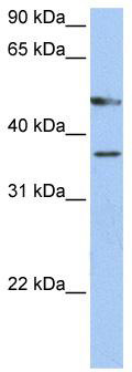 WB Suggested Anti-FOXD4 Antibody Titration: 0.2-1 ug/ml; Positive Control: Hela cell lysate