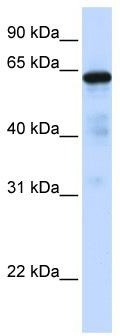 WB Suggested Anti-FOXN4 Antibody Titration: 0.2-1 ug/ml; ELISA Titer: 1: 312500; Positive Control: Hela cell lysate