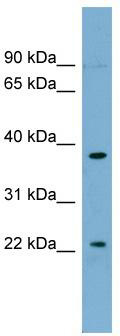 WB Suggested Anti-FOXN4 Antibody Titration: 0.2-1 ug/ml; ELISA Titer: 1: 62500; Positive Control: OVCAR-3 cell lysate