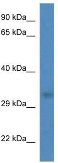 WB Suggested Anti-Thg1l Antibody; Titration: 1.0 ug/ml; Positive Control: Mouse Spleen