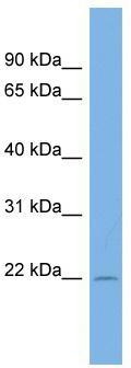 WB Suggested Anti-C13orf28 Antibody Titration: 0.2-1 ug/ml; ELISA Titer: 1: 62500; Positive Control: COLO205 cell lysate