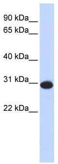 Western blot analysis of extracts of various cell lines, using ESPL1 antibody (TA375991) at 1:1000 dilution.|Secondary antibody: HRP Goat Anti-Rabbit IgG (H+L) at 1:10000 dilution.|Lysates/proteins: 25ug per lane.|Blocking buffer: 3% nonfat dry milk in TBST.|Detection: ECL Enhanced Kit .|Exposure time: 30s.