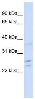 WB Suggested Anti-TPD52 Antibody Titration: 0.2-1 ug/ml; ELISA Titer: 1: 312500; Positive Control: Jurkat cell lysate.TPD52 is strongly supported by BioGPS gene expression data to be expressed in Human Jurkat cells