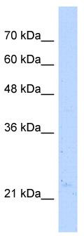 Western blot analysis of extracts of various cell lines, using FABP5 antibody (TA376073) at 1:1000 dilution.|Secondary antibody: HRP Goat Anti-Rabbit IgG (H+L) at 1:10000 dilution.|Lysates/proteins: 25ug per lane.|Blocking buffer: 3% nonfat dry milk in TBST.|Detection: ECL Basic Kit .|Exposure time: 30s.
