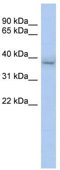 WB Suggested Anti-KLHDC8B Antibody Titration: 0.2-1 ug/ml; ELISA Titer: 1: 62500; Positive Control: Human Stomach
