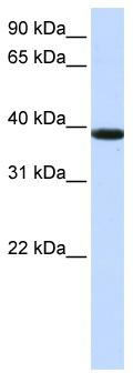 WB Suggested Anti-KLHDC8B Antibody Titration: 0.2-1 ug/ml; ELISA Titer: 1: 62500; Positive Control: Jurkat cell lysate