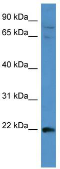 WB Suggested Anti-MAP3K15 Antibody Titration: 0.2-1 ug/ml; ELISA Titer: 1: 62500; Positive Control: HepG2 cell lysate