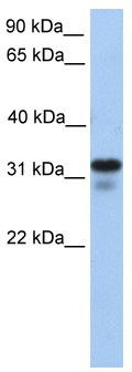 WB Suggested Anti-HS3ST6 Antibody Titration: 0.2-1 ug/ml; Positive Control: 721_B cell lysate