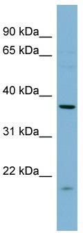 WB Suggested Anti-FNTA Antibody Titration: 0.2-1 ug/ml; ELISA Titer: 1: 2500; Positive Control: THP-1 cell lysate