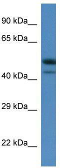 WB Suggested Anti-Sbk1 Antibody; Titration: 1.0 ug/ml; Positive Control: Mouse Thymus