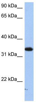 WB Suggested Anti-SULT6B1 Antibody Titration: 0.2-1 ug/ml; Positive Control: HepG2 cell lysate
