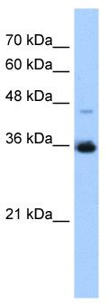 WB Suggested Anti-GGPS1 Antibody Titration: 0.2-1 ug/ml; Positive Control: HepG2 cell lysate