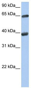 Western blot analysis of extracts of Rat skeletal muscle, using Fibroblast activation protein-α (FAP) antibody (TA376125) at 1:1000 dilution.|Secondary antibody: HRP Goat Anti-Rabbit IgG (H+L) at 1:10000 dilution.|Lysates/proteins: 25ug per lane.|Blocking buffer: 3% nonfat dry milk in TBST.|Detection: ECL Basic Kit .|Exposure time: 180s.