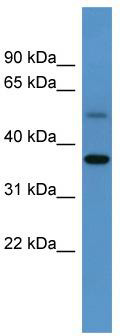 WB Suggested Anti-Gyg Antibody Titration: 0.2-1 ug/ml; ELISA Titer: 1: 62500; Positive Control: Mouse Kidney