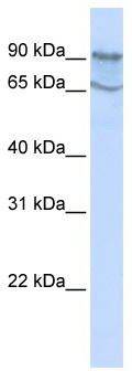 WB Suggested Anti-MAP4K2 Antibody Titration: 0.2-1 ug/ml; ELISA Titer: 1: 12500; Positive Control: HepG2 cell lysate