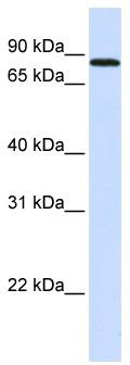 WB Suggested Anti-MAP4K2 Antibody Titration: 0.2-1 ug/ml; ELISA Titer: 1: 312500; Positive Control: Human Liver