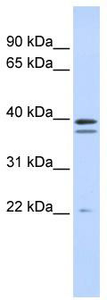 WB Suggested Anti-RABGGTB Antibody Titration: 0.2-1 ug/ml; ELISA Titer: 1: 62500; Positive Control: Human brain