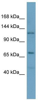 Host: Rabbit; Target Name: POLRMT; Sample Tissue: OVCAR-3 Whole Cell lysates; Antibody Dilution: 1.0 ug/ml.POLRMT is supported by BioGPS gene expression data to be expressed in OVCAR3