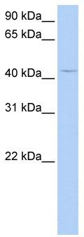 WB Suggested Anti-PECI Antibody Titration: 0.2-1 ug/ml; ELISA Titer: 1: 62500; Positive Control: HepG2 cell lysate.ECI2 is supported by BioGPS gene expression data to be expressed in HepG2