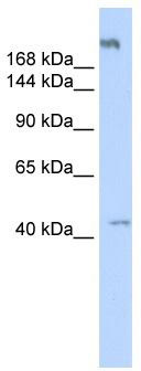 WB Suggested Anti-POLR3A Antibody Titration: 0.2-1 ug/ml; ELISA Titer: 1: 312500; Positive Control: Human Muscle