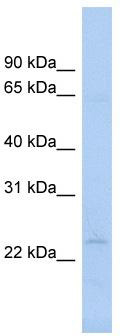 WB Suggested Anti-NAT9 Antibody Titration: 0.2-1 ug/ml; ELISA Titer: 1: 62500; Positive Control: Human brain