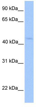 WB Suggested Anti-LIPT1 Antibody Titration: 0.2-1 ug/ml; Positive Control: Hela cell lysate