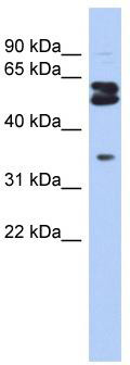 WB Suggested Anti-OGFOD1 Antibody Titration: 0.2-1 ug/ml; ELISA Titer: 1: 62500; Positive Control: DU145 cell lysate; OGFOD1 is supported by BioGPS gene expression data to be expressed in DU145