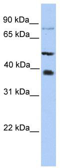 WB Suggested Anti-METTL2B Antibody Titration: 0.2-1 ug/ml; Positive Control: HepG2 cell lysate