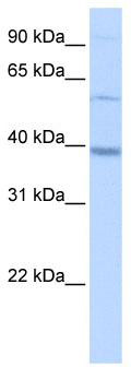 WB Suggested Anti-METTL2B Antibody Titration: 0.2-1 ug/ml; Positive Control: HepG2 cell lysate