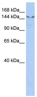 WB Suggested Anti-UGCGL2 Antibody Titration: 0.2-1 ug/ml; ELISA Titer: 1: 62500; Positive Control: HepG2 cell lysate. UGGT2 is supported by BioGPS gene expression data to be expressed in HepG2