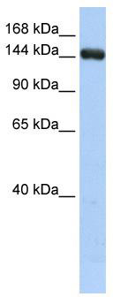 WB Suggested Anti-UGCGL2 Antibody Titration: 0.2-1 ug/ml; ELISA Titer: 1: 12500; Positive Control: HepG2 cell lysate. UGGT2 is supported by BioGPS gene expression data to be expressed in HepG2