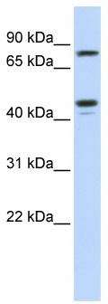 WB Suggested Anti-CHST6 Antibody Titration: 0.2-1 ug/ml; ELISA Titer: 1: 312500; Positive Control: Jurkat cell lysate