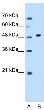 The FITC rabbit polyclonal antibody (TA376256) are tested in Western blot against FITC conjugated Goat IgG,TRITC conjugated Goat IgG and unconjugated Goat IgG|Secondary antibody: HRP Goat Anti-Rabbit IgG (H+L) at 1:10000 dilution.|Lysates/proteins: Refer to figures.|Blocking buffer: 3% nonfat dry milk in TBST.|Detection: ECL Basic Kit .|Exposure time: 1s.