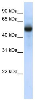 WB Suggested Anti-CXorf34 Antibody Titration: 0.2-1 ug/ml; ELISA Titer: 1: 1562500; Positive Control: Human brain