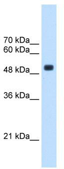 WB Suggested Anti-CXorf34 Antibody Titration: 2.5 ug/ml; Positive Control: HepG2 cell lysate