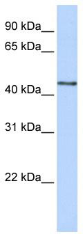 WB Suggested Anti-B3GNT4 Antibody Titration: 0.2-1 ug/ml; ELISA Titer: 1: 312500; Positive Control: 293T cell lysate