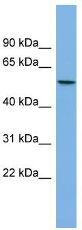 WB Suggested Anti-AGXT2L1 Antibody Titration: 0.2-1 ug/ml; Positive Control: PANC1 cell lysate