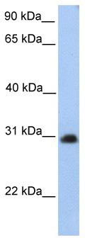 WB Suggested Anti-CHST14 Antibody Titration: 0.2-1 ug/ml; Positive Control: HepG2 cell lysate