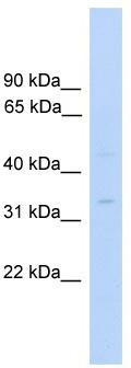 WB Suggested Anti-MTFMT Antibody Titration: 0.2-1 ug/ml; ELISA Titer: 1:1562500; Positive Control: Human Fetal Liver