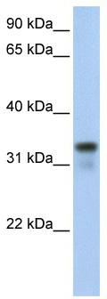 WB Suggested Anti-GLYATL2 Antibody Titration: 0.2-1 ug/ml; Positive Control: 721_B cell lysate