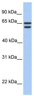 WB Suggested Anti-CDYL2 Antibody Titration: 0.2-1 ug/ml; Positive Control: 721_B cell lysate