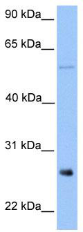 WB Suggested Anti-METTL7B Antibody Titration: 0.2-1 ug/ml; Positive Control: Jurkat cell lysate