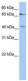 WB Suggested Anti-CHST13 Antibody Titration: 0.2-1 ug/ml; Positive Control: HepG2 cell lysate